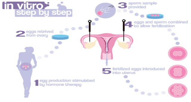 大量国内外研究表明，针刺可以提高卵泡液中干细胞因子水平[1]提升卵子质量，增强子宫和卵巢组织的血流、降低子宫动脉血流阻抗[2,3]，调节IVF-ET胚胎着床期的激素平衡[4]，从而改善妊娠结局，提高活产率。