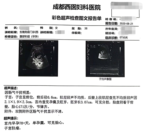 移植50天后，B超确认宫内早孕70+天，单孕囊，可见胎心。