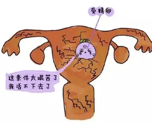 PRP新疗法，破解「子宫内膜薄」难题！