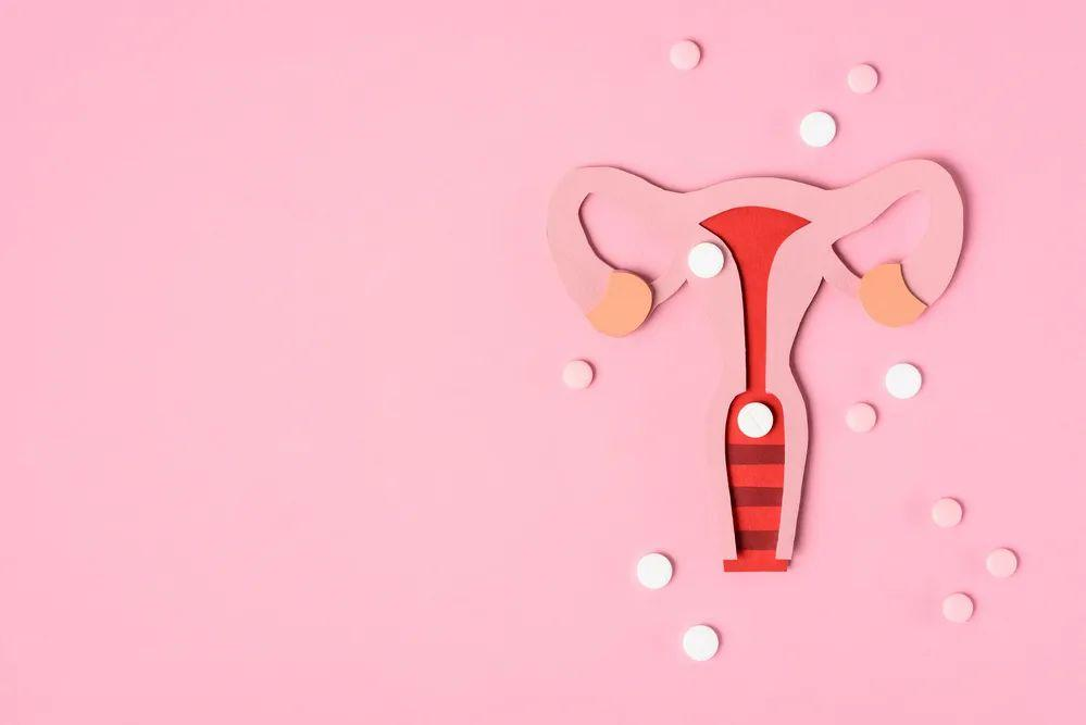 多囊卵巢综合征为什么月经总是不规律？除了吃避孕药还可以怎么办呢？
