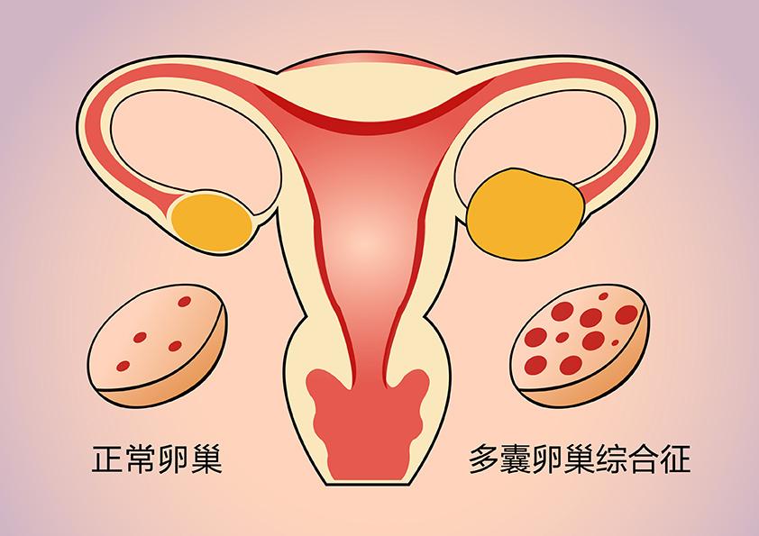 医生说 ，这么个病，竟然让无数人以为得了“不治之症”？！