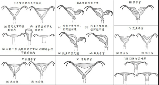 放置扩宫棒示意图图片