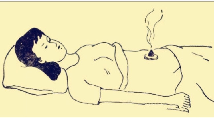 脐灸的注意事项