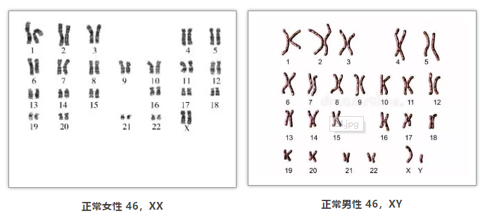 人类染色体组图图片