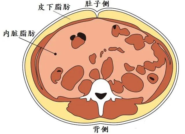 皮下脂肪和内脏脂肪示意图