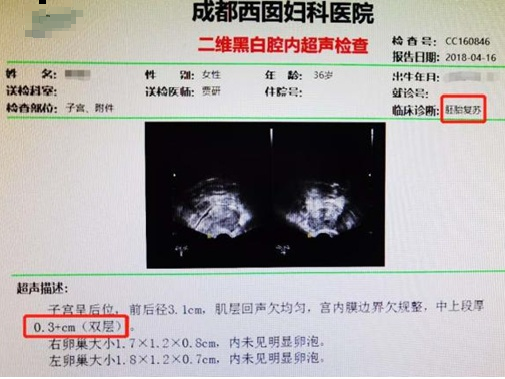 成都西囡妇科医院，二维黑白腔内超声（B超）检查结果