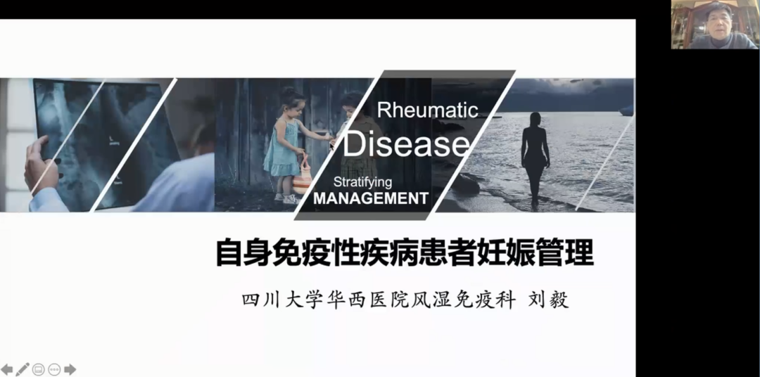 四川大学华西医院风湿免疫科主任 刘毅教授