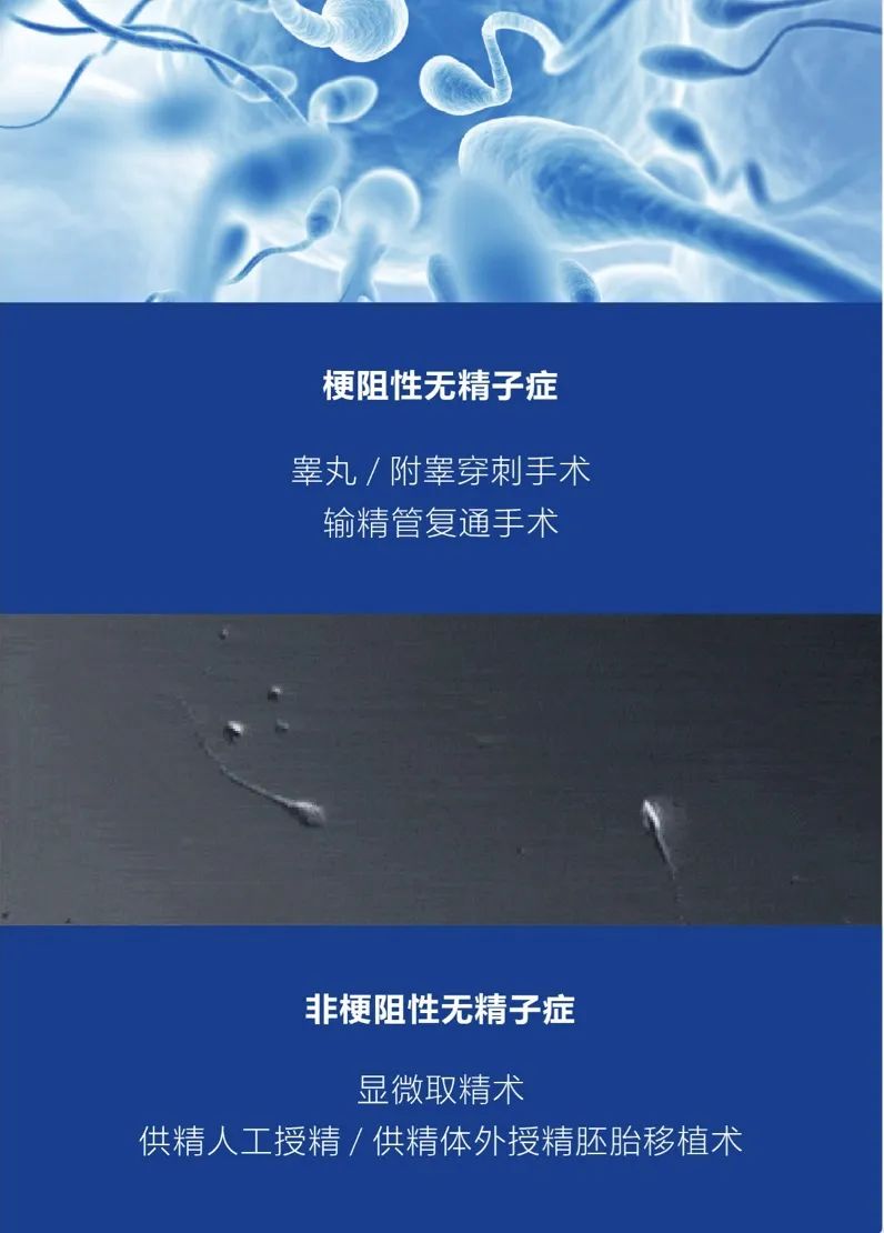 梗阻性无精子症 睾丸/附睾穿刺手术输精管复通手术 非梗阻性无精子症 显微取精术 供精人工授精/供精体外授精胚胎移植术