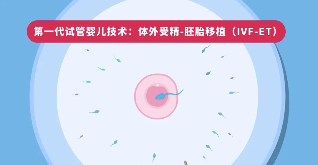 第一代试管婴儿技术:体外受精-胚胎移植 (IVF-ET)