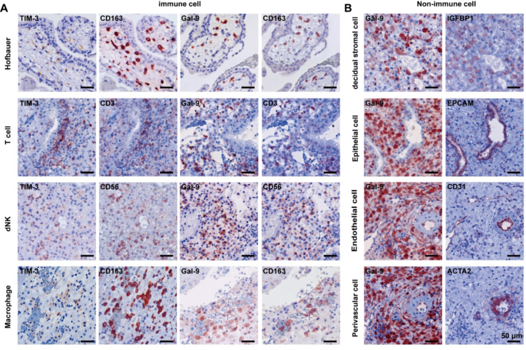 母体蜕膜中的T细胞、NK细胞、巨噬细胞等免疫细胞均高表达TIM-3与Galectin-9，二者协同作用抑制过度炎症反应，维持免疫耐受