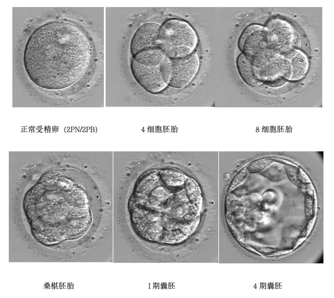 受精后的早期胚胎发育过程