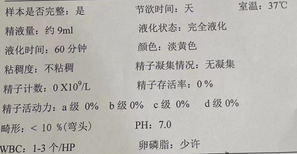 从0条精子到600条精子，看我院男科如何助力「无精症」夫妇圆梦