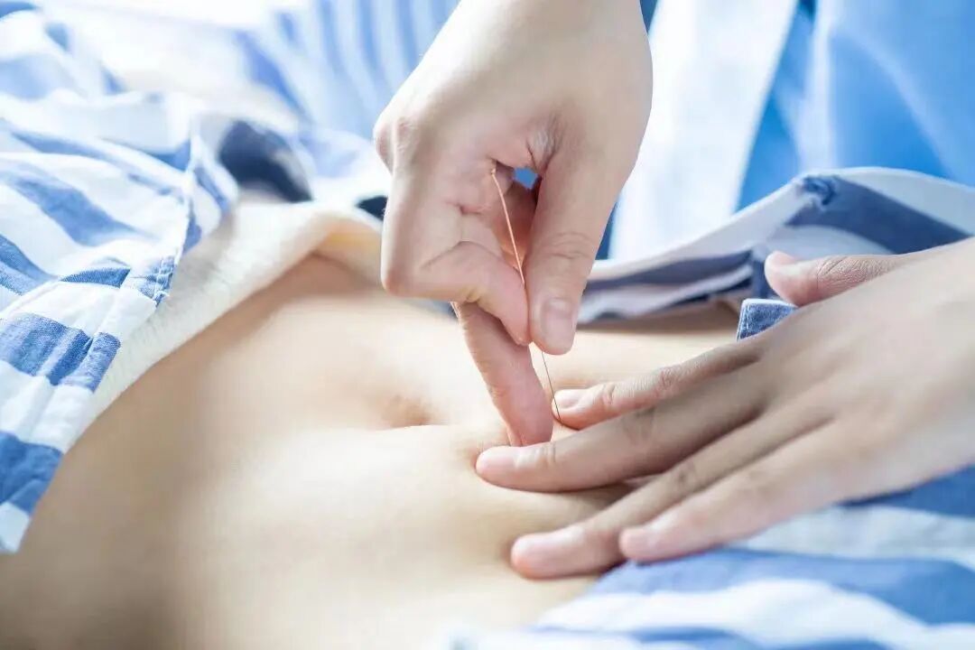 分析既往子宫内膜容受结果，通过应用补肾健脾、疏肝理气、益气养血等中医理论，运用鼎灸等特色治疗，配合穴位埋线、放血疗法、中药灌肠、腔内治疗等治疗方式